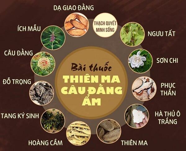 Điều trị tai biến mạch máu não theo Y học cổ truyền cải thiện di chứng